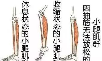 半夜小腿「突然抽筋」,你還在傻傻地以為是缺鈣嗎?可醫生卻說還有這幾種情況
