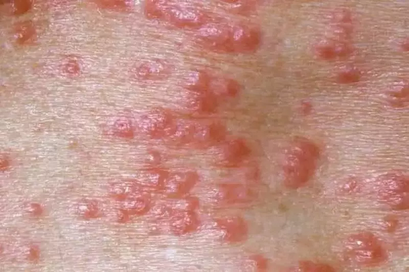 狗狗身上全是蟎蟲,都是錯誤清潔惹的禍