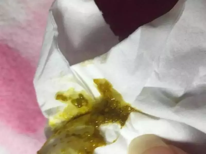 狗狗身上全是蟎蟲,都是錯誤清潔惹的禍