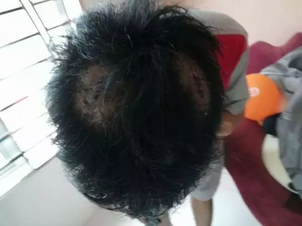 1個打4個!家入賊為護妻兒與匪博斗,工程師頭破血流失財 -