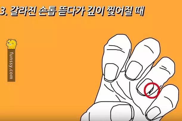 10個會讓你「痛到抓狂的瞬間」 #10趴在桌子上睡覺，結果手麻了