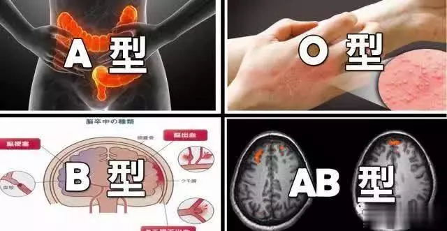 O型易「中風」,A型多「便秘」!四大血型「疾病風險」,一秒看懂血液危機