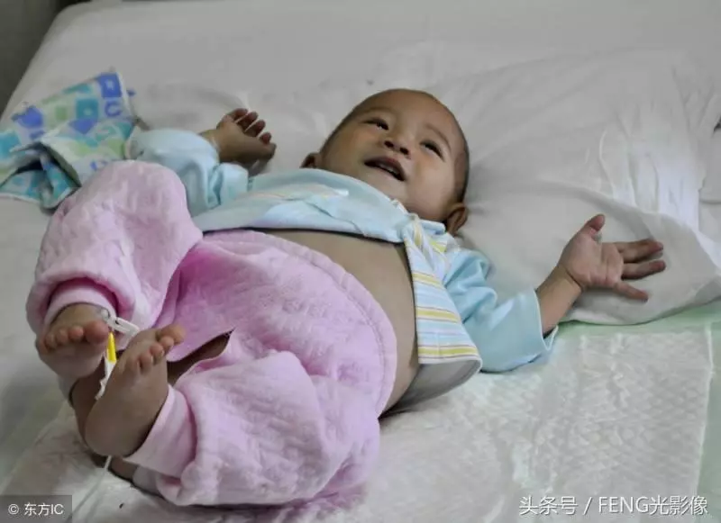 史上最小「孕婦」,18月大就成為「准媽媽」,親生父母系全責 -