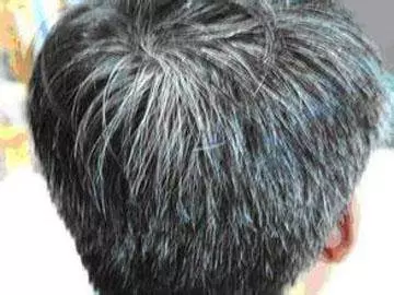 年輕就長滿白髮?教你這樣吃,有助於長黑髮