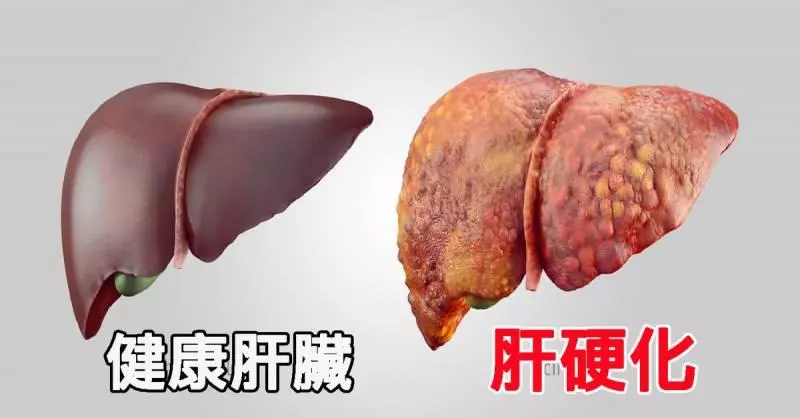 原來馬鈴薯+紅蘿蔔+蘋果,打成汁來喝,竟然有那麼多功效!