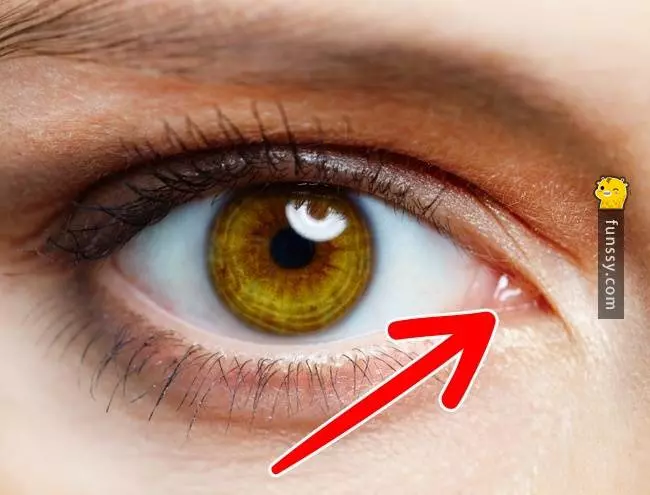 15個會在未來慢慢消失的人類器官 #10 第三眼瞼?
