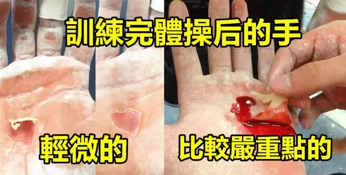 16張照片會讓你打從心底佩服體操選手們第12張太誇張了 看到都怕 (為了取得好成績,他們付出了太多)