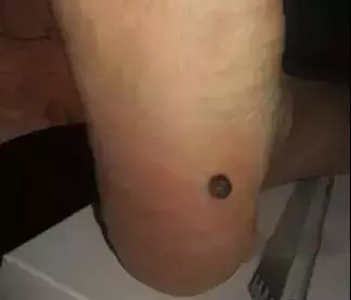 腳上的生命密碼,一病一絕招,太難得了!