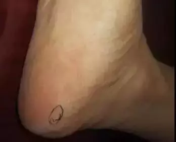 腳上的生命密碼,一病一絕招,太難得了!