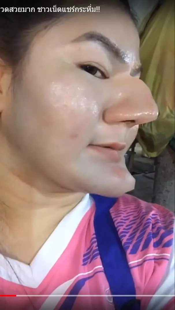 「我很滿意新鼻子和下巴!」泰女整形完開心自拍 一轉頭月亮爬上臉...