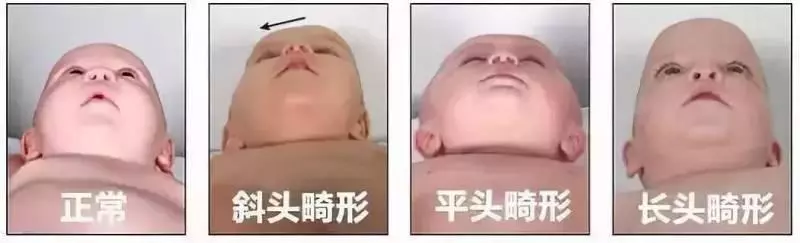 如何睡出完美頭型,這些知識要知道