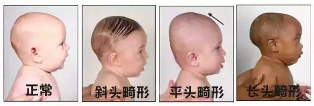 如何睡出完美頭型,這些知識要知道