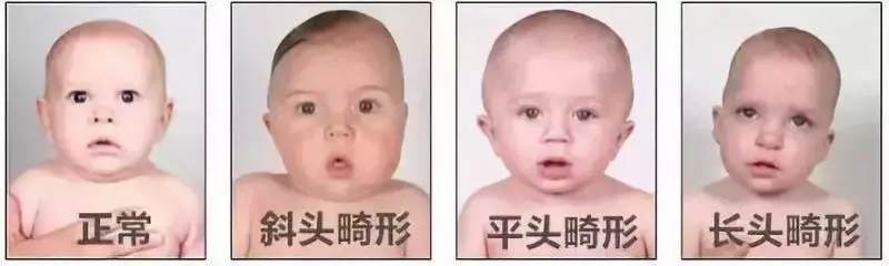 如何睡出完美頭型,這些知識要知道