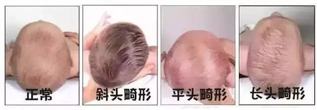 如何睡出完美頭型,這些知識要知道