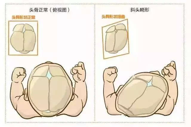 如何睡出完美頭型,這些知識要知道