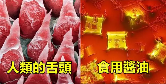 如果世界被放大2000倍的話 這就是我們將會看到的超驚悚世界#15指甲近看竟然是長這樣…