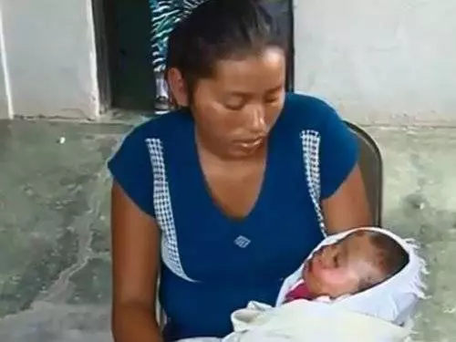 7個月大女嬰死後 葬禮上突然復活