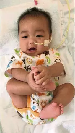 [ 新加坡 ] 換肝成功男嬰出院了 服抗排斥藥暫謝絕探望