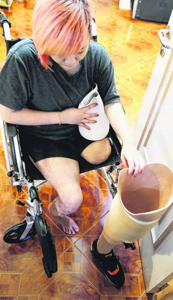 深夜騎摩哆送女友回家釀一死一傷慘禍,女友拋飛鋸腿保命, 斷腿美女向男友家索賠