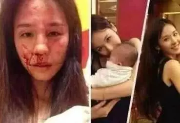 嫁億萬豪門遭7次家暴,生產前一天被打,妹妹為救她被打掉門牙