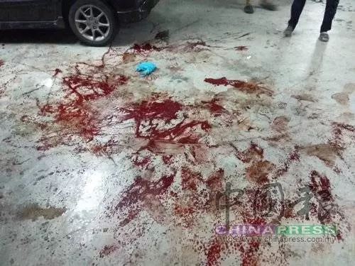 疑不甘戴綠帽 醋夫砍斷妻子左手掌