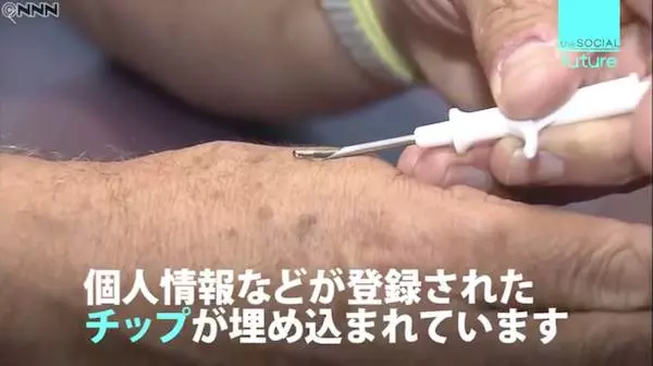 世上最猛的無現金國家 瑞典推「人體晶片」植入皮膚下付款