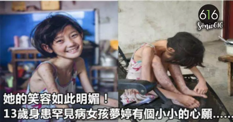 她的笑容如此明媚,13歲身患罕見病女孩夢婷有個小小的心願……