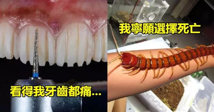 30張挑戰你忍耐力的超極致照片~~~ #1 好惡心這團是什麼東西啊?