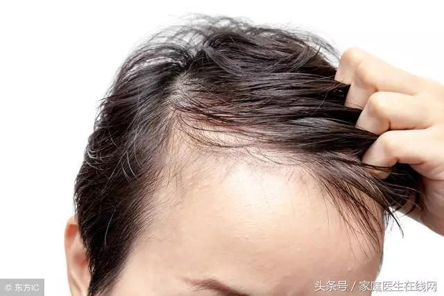 年紀輕輕就白了頭髮?原因很明顯,八成是這3點造成的