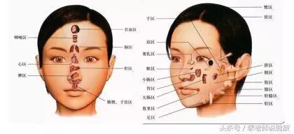 老年斑是怎麼形成的?治療老年斑有妙方