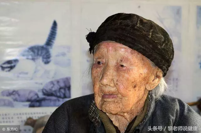 老年斑是怎麼形成的?治療老年斑有妙方