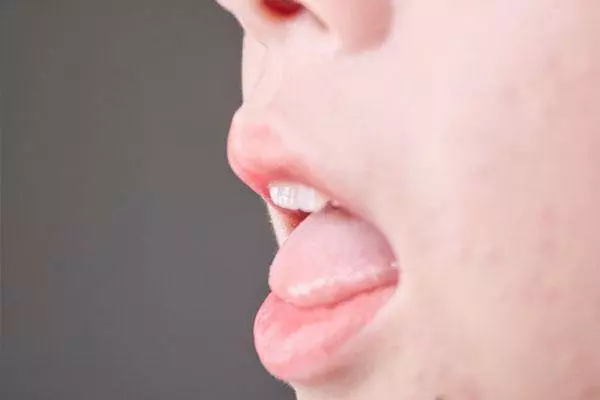 血糖高不高?看舌頭就知道,出現這3種症狀,可能是血糖升高了