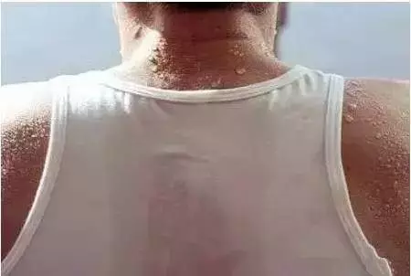 睡覺時突然小腿抽筋,千萬別以為只是缺鈣
