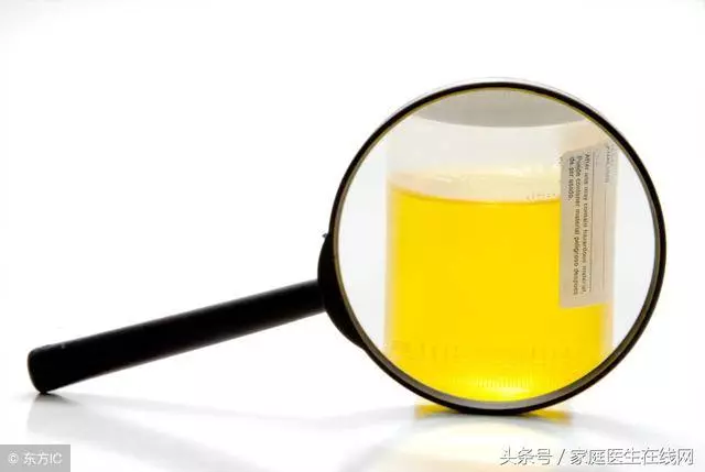 尿液很黃有異味?若有這1種情況,請您馬上就醫