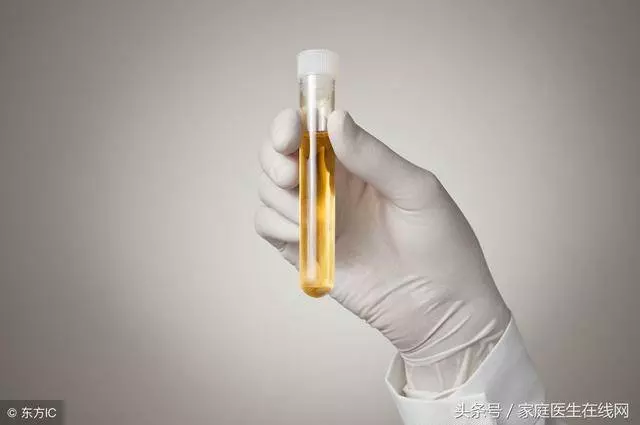 尿液很黃有異味?若有這1種情況,請您馬上就醫