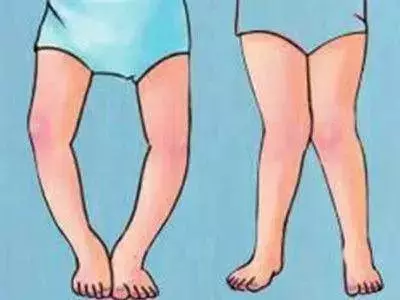 走路是最健康的良藥這樣走路可以【走掉4種】疾病年過40的人都需要