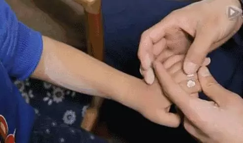 小兒推拿21種手法,輕松搞定幾種常見病