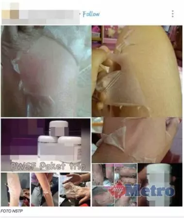 [ 大馬 ] 含維生素C美白針 大馬仍禁用