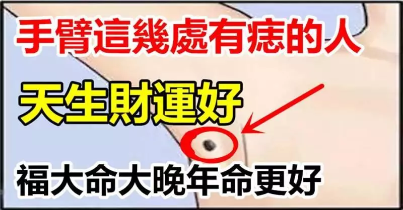 你手臂的痣,暴露了你的財富