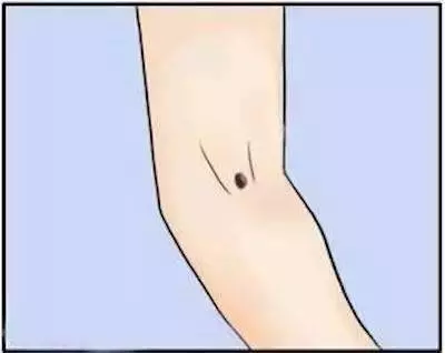 你手臂的痣,暴露了你的財富
