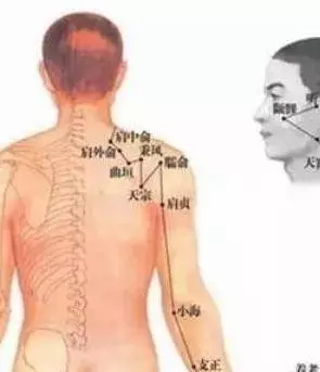 手麻,脖子一轉哢哢響?3個穴位按摩,活氣血通經絡,緩解頸椎病