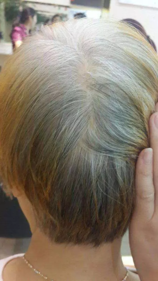 白髮別急著染,用幾塊錢的小偏方就能根治
