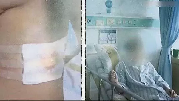 原來與體型有關 瘦男伸懶腰後竟爆肺