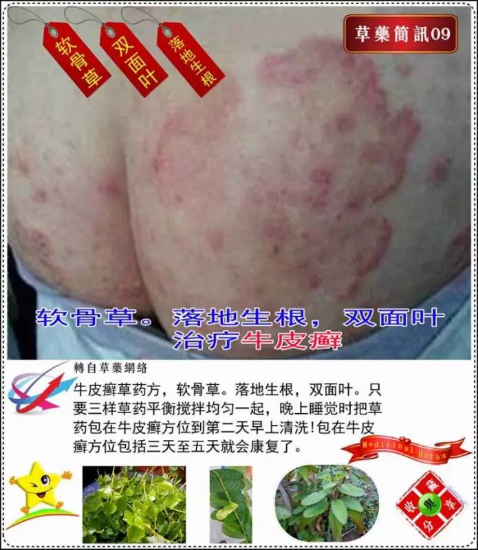 30種草藥簡訊!!必要收藏起來!!!