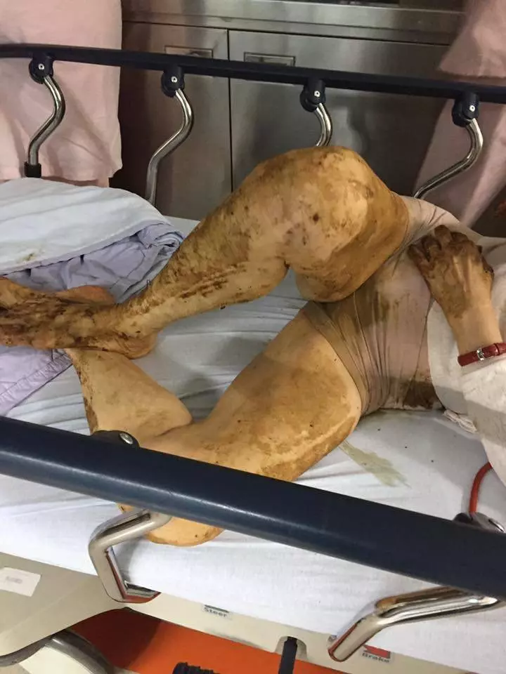 獨居嬤糞便沾滿身 護理師無怨幫清洗網感動讚:無私大愛