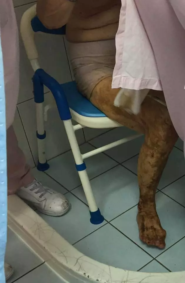 獨居嬤糞便沾滿身 護理師無怨幫清洗網感動讚:無私大愛