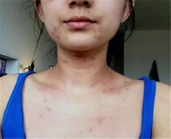 腎好人不老,當身體出現這「六大警示」後,表示腎臟在求救