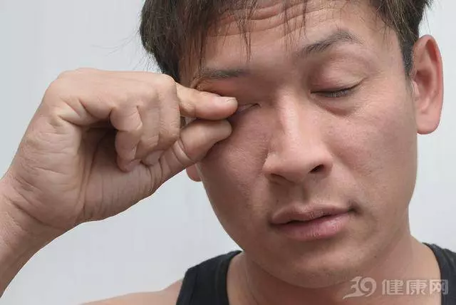 早上起床眼屎多,可能暗示4種病別想得太簡單
