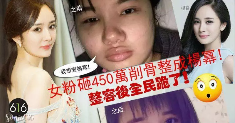 我想變楊冪:女粉砸450萬削骨整成楊冪,整容後全民跪了