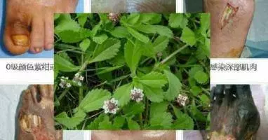 一顆小草竟治好了婆婆糖尿病腳爛 (就算爛腳也治得好而且傷口也癒合)請轉分享給身邊朋友吧